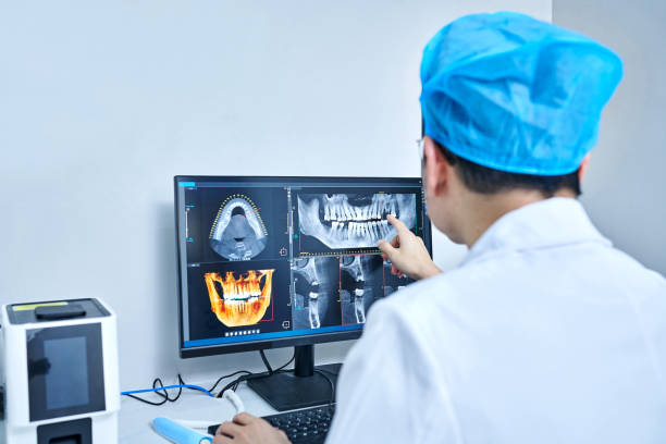 Best Emergency Wisdom Teeth Removal in Voorheesville, NY